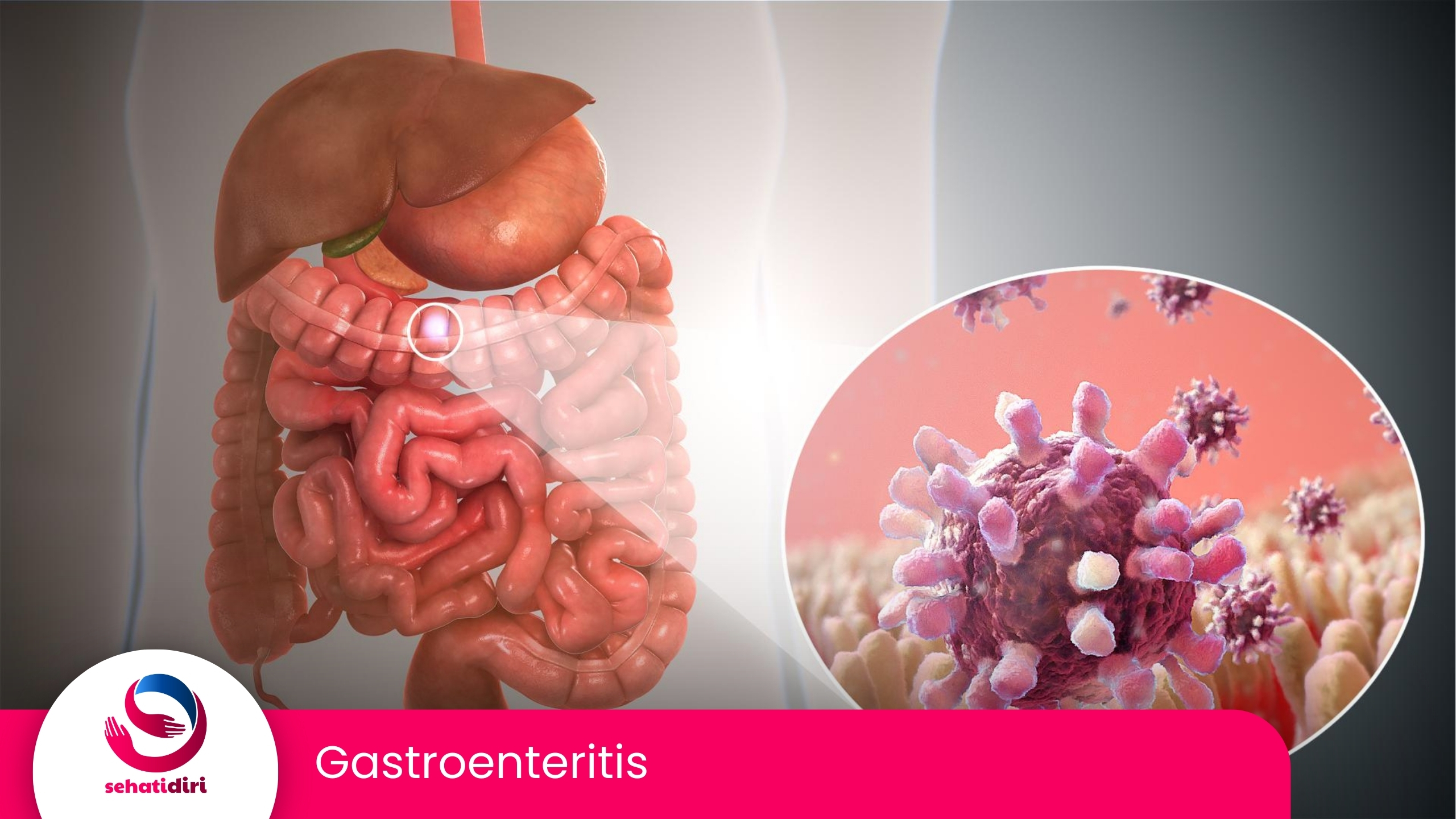 Gastroenteritis