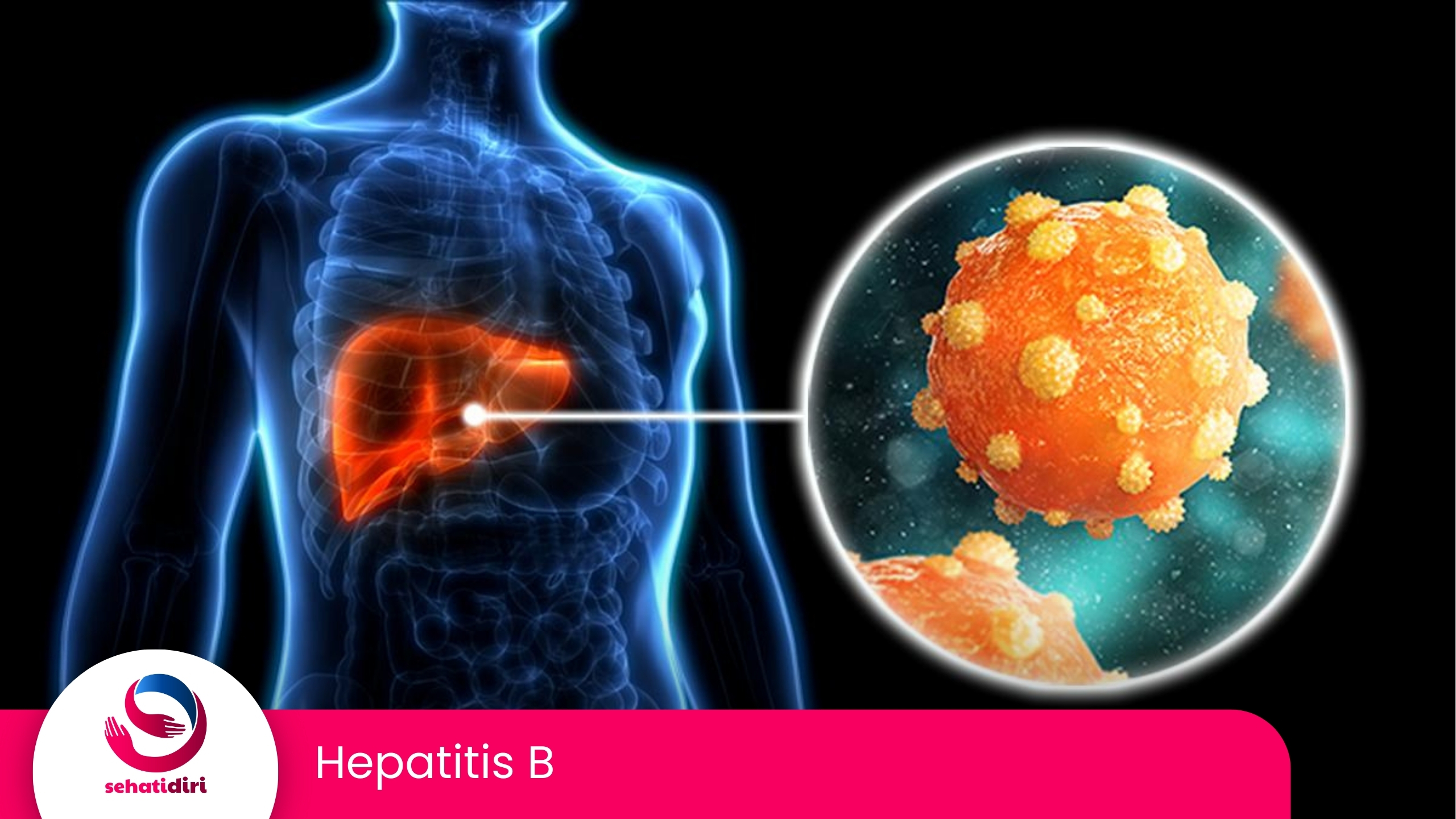 Hepatitis B