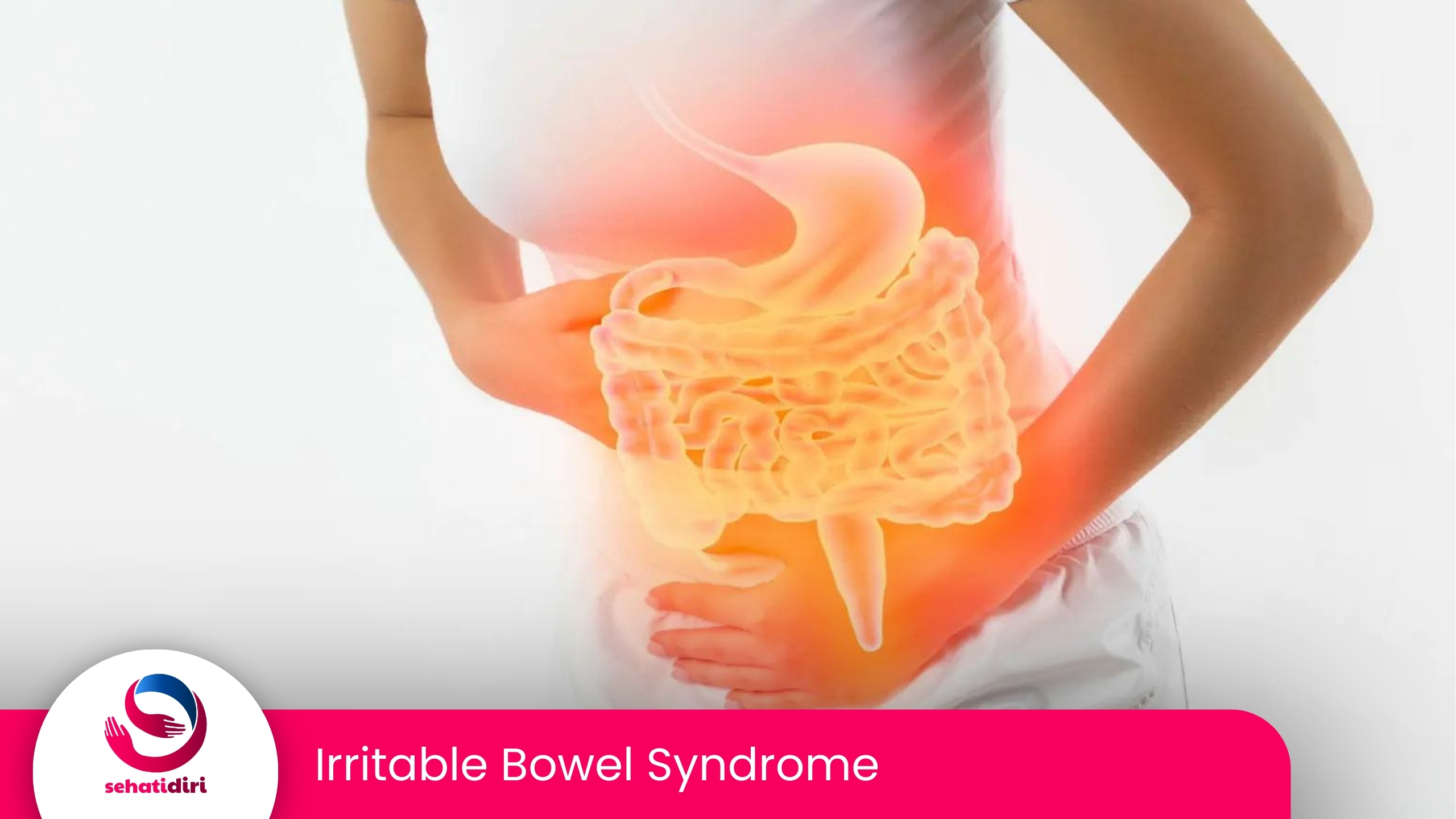 Irritable Bowel Syndrome