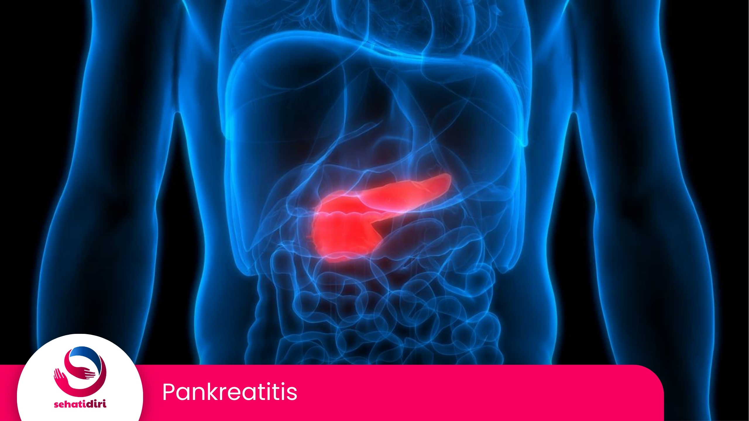 Pankreatitis