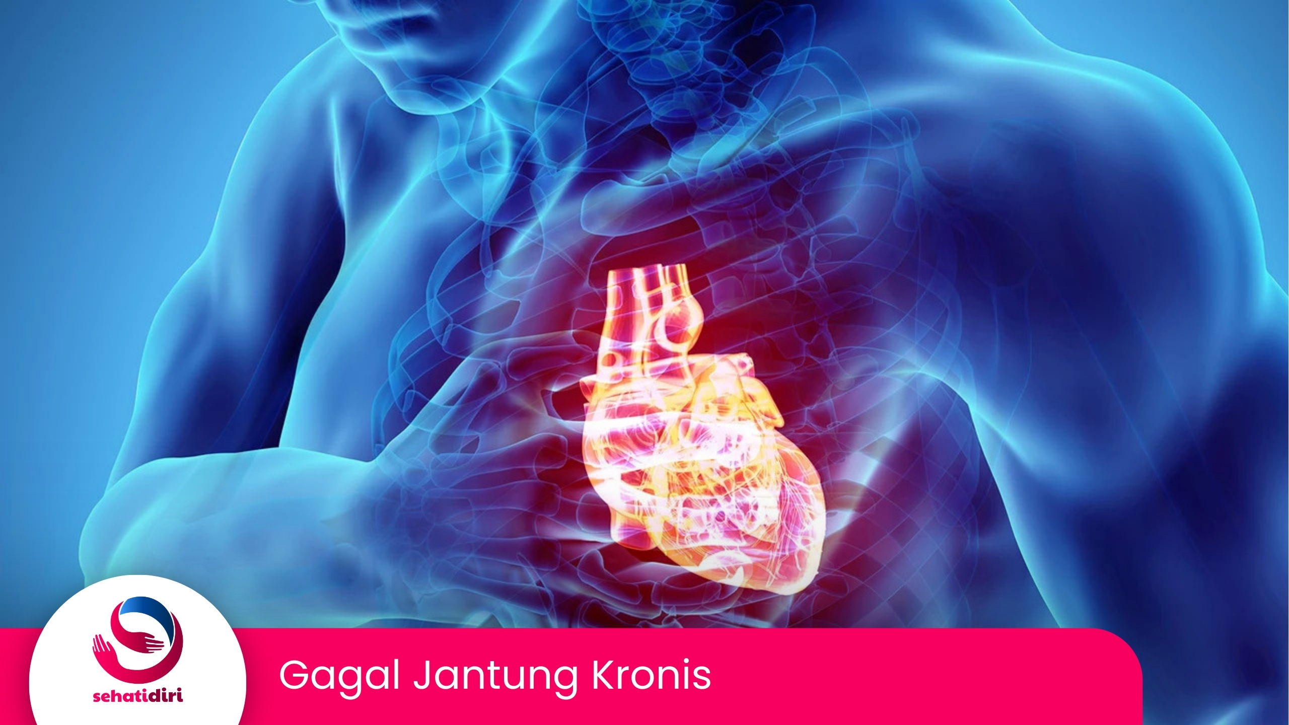 Gagal Jantung Kronis