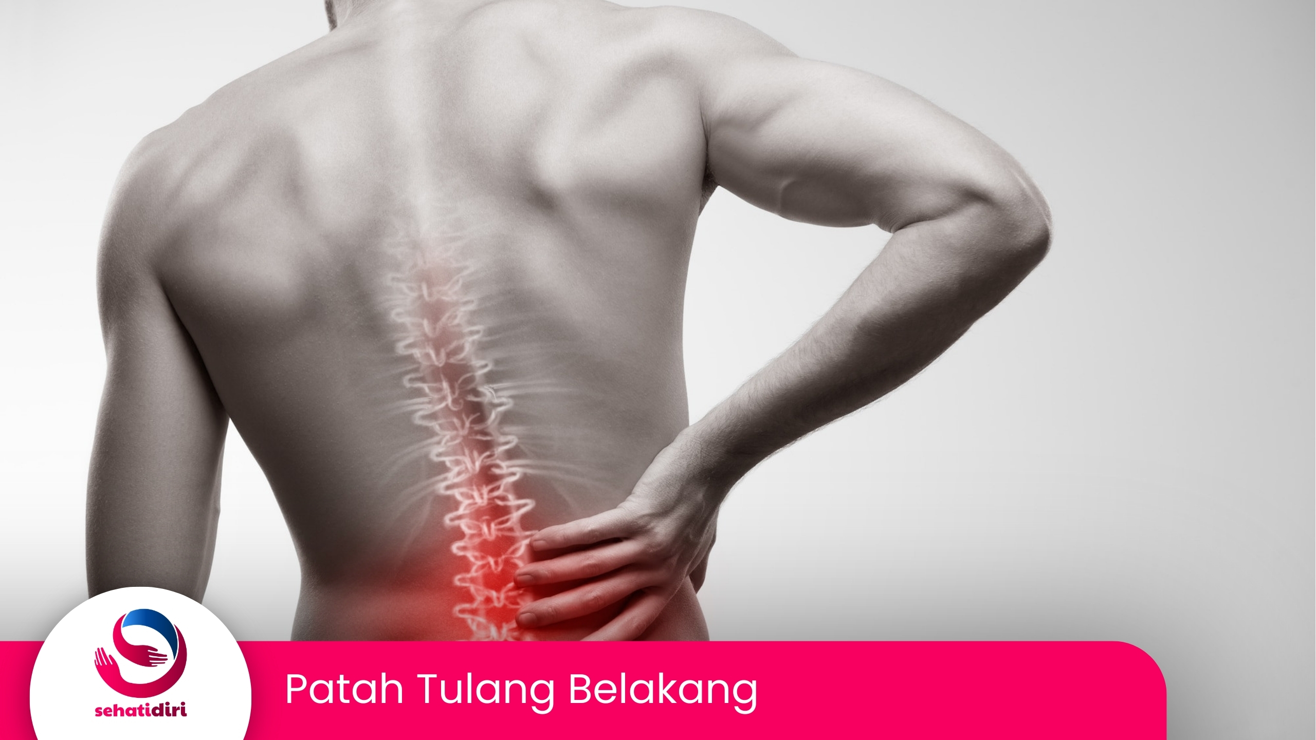 Patah Tulang Belakang