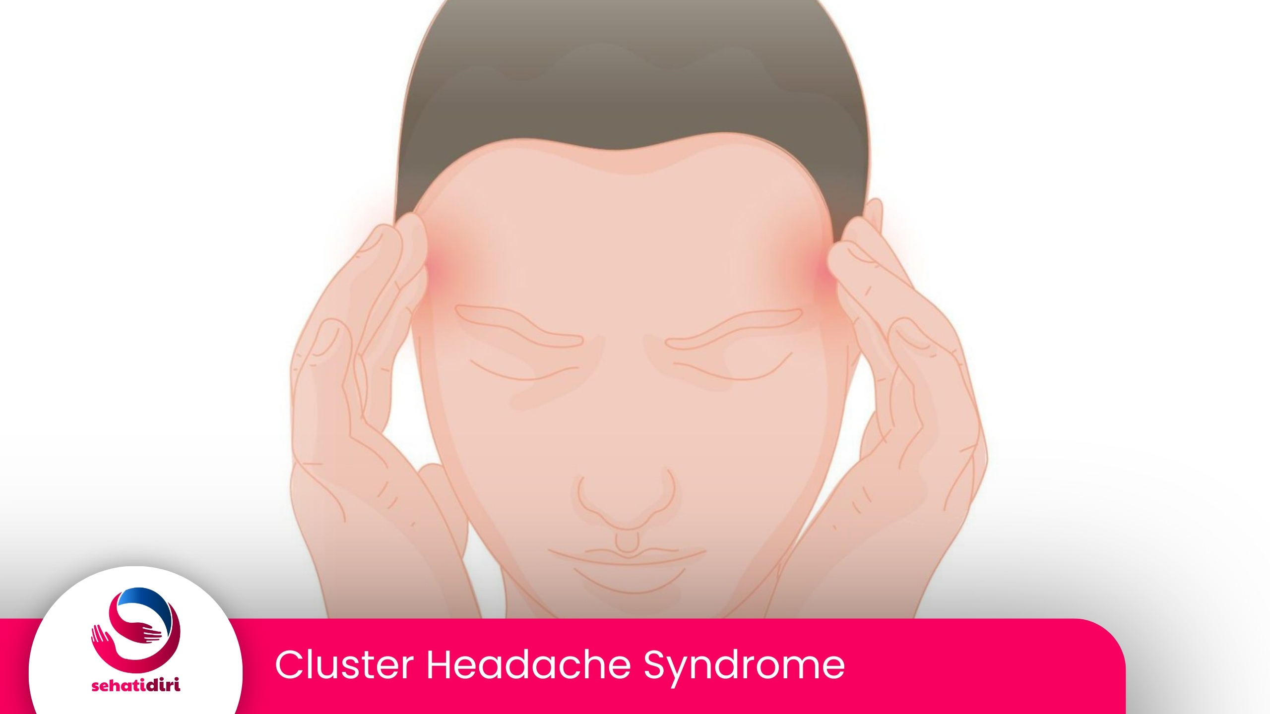 Cluster Headache Syndrome