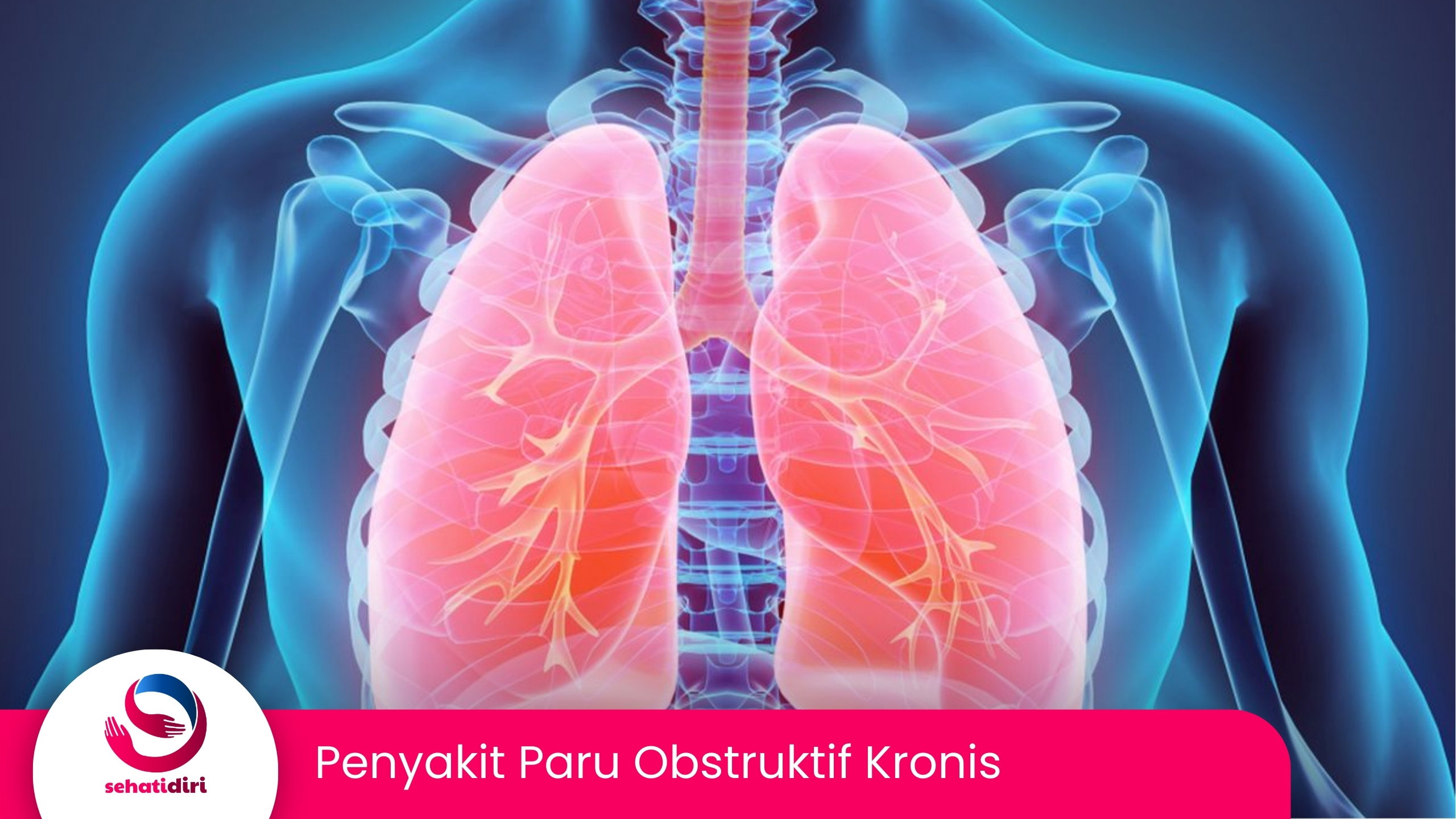 Penyakit Paru Obstruktif Kronis