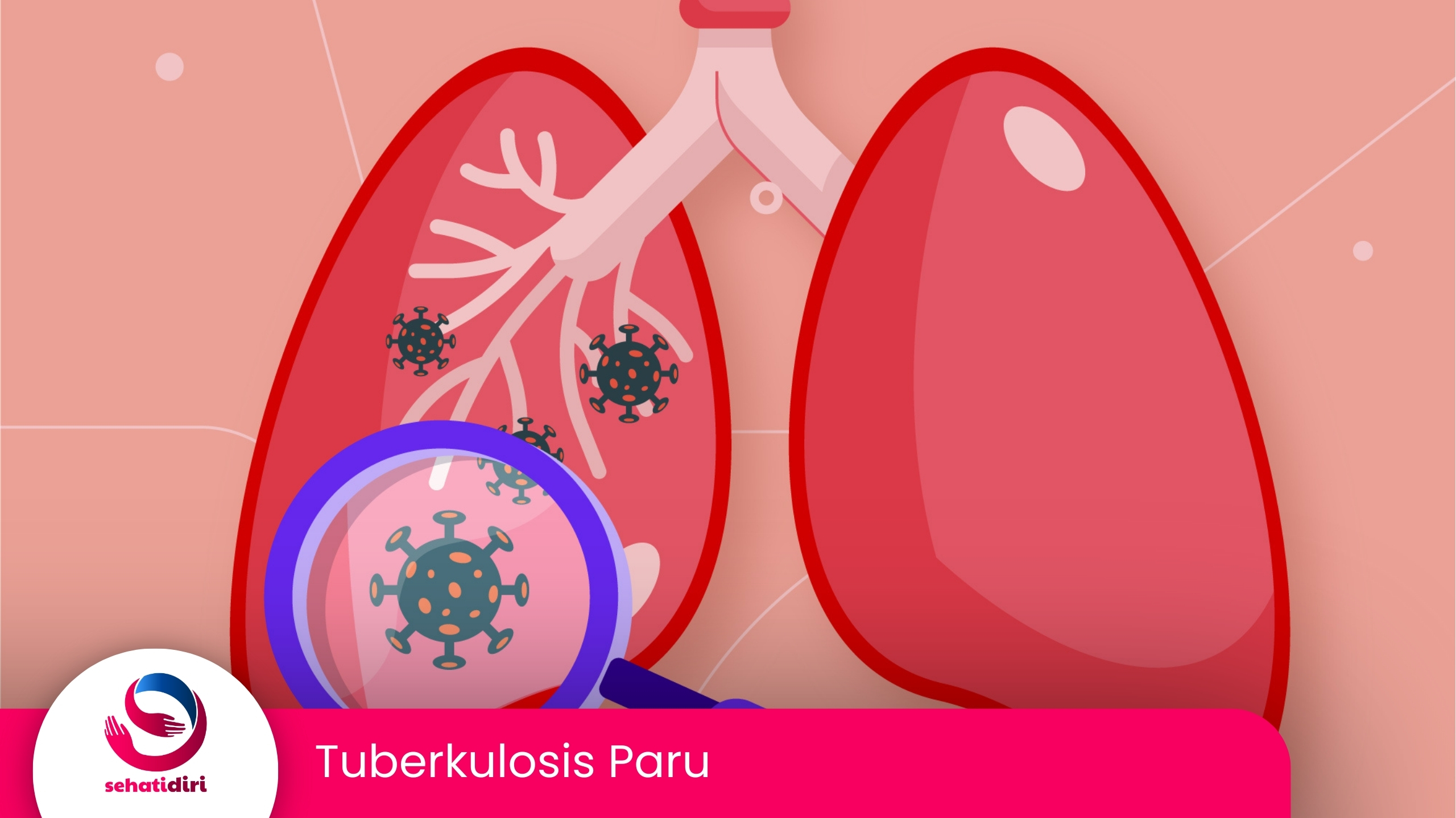 Tuberkulosis Paru